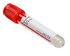 BD Vacutainer 2ml Plastic Serum Tube Rød