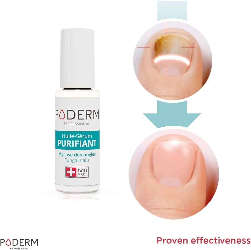 Poderm Fungal Nails 8ml - UKMEDI